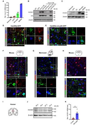 Neutralization of Hv1/HVCN1 With Antibody Enhances Microglia/Macrophages Myelin Clearance by Promoting Their Migration in the Brain